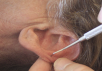 Réflexologie Auriculaire du 18 au 21 septembre 2026